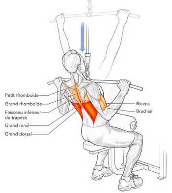 Tirage-poitrine à la poulie haute avec les mains très écartées